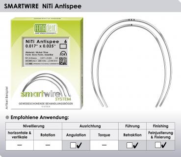 Preview: SMARTWIRE NiTi Antispee